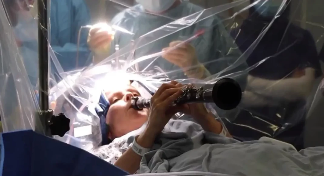 Mulher com Parkinson toca clarinete durante operação ao cérebro; veja!