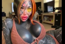 Modelo que gastou R$ 2,6 milhões em cirurgias choca com foto antiga; veja