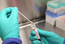 Casos de mpox mais que dobram em 20 dias, com 129 confirmações no Brasil