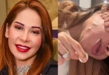 Famosas admitem seus maiores arrependimentos de beleza: “Não façam”